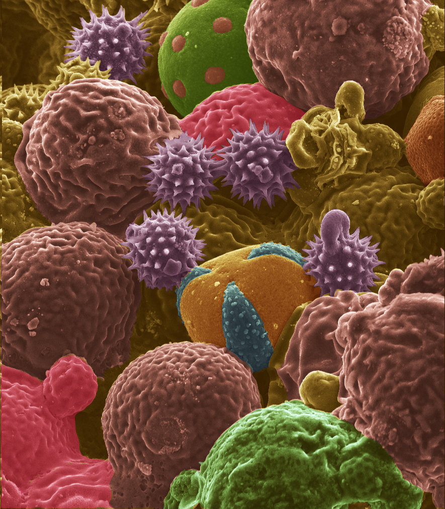 scanning electron microscope image shows bee pollen