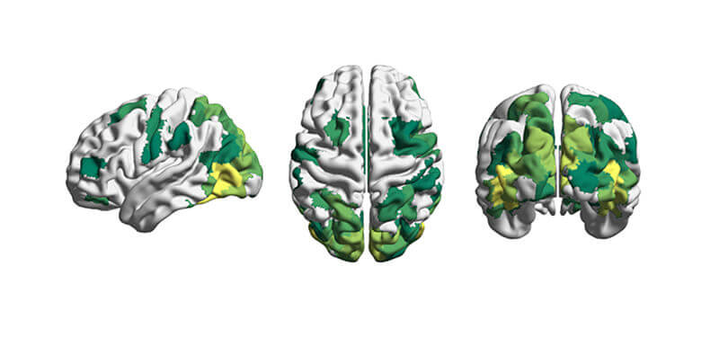 brain-reconfiguration